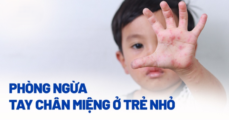 Tay chân miệng ở trẻ em: Cách phát hiện và phòng ngừa